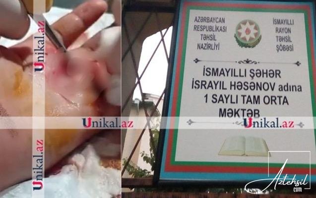 Şagird sinif yoldaşını yaralayıb , sinif rəhbəri hadisəni gizlədib