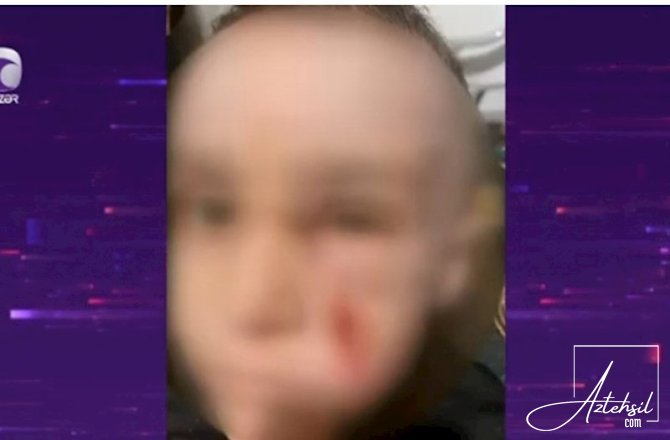 Bakıda bağçada uşaq xəsarət alıb